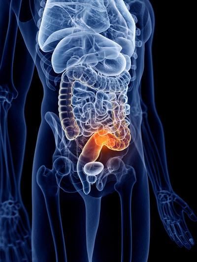 Digestieve oncologie - tumoren maag darm lever pancreas