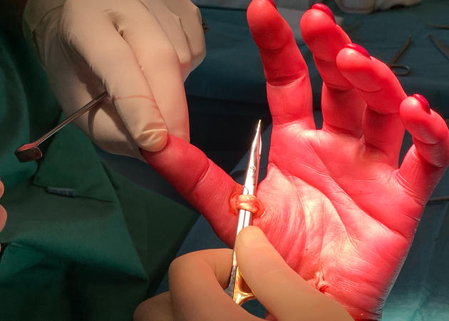 Walant, een nieuwe techniek voor handchirurgie